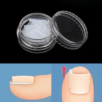 Kit de pédicure pour ongles incarnés, 50 pièces – image 3