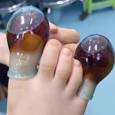 Protège-orteils en silicone souple, réutilisable